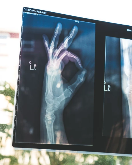 AI and Precision Medicine